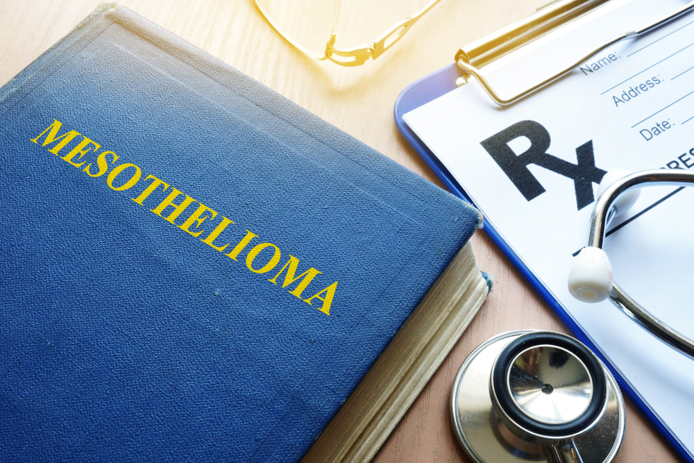 Filing a FELA Claim After Asbestos Exposure